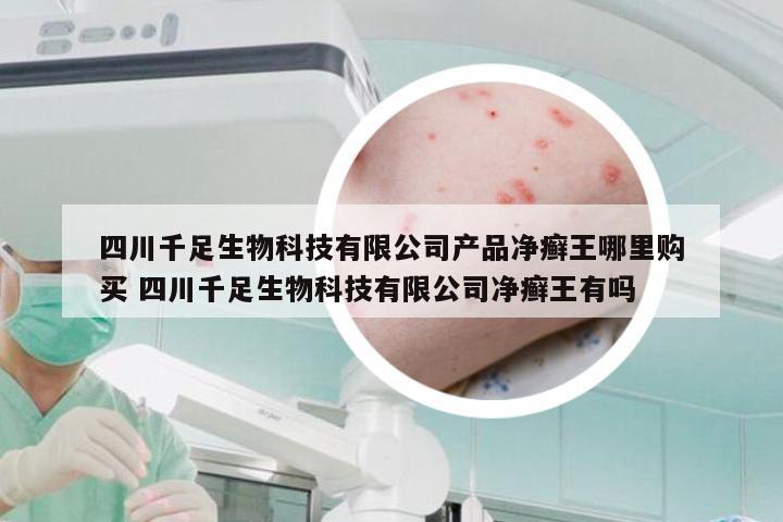 四川千足生物科技有限公司产品净癣王哪里购买 四川千足生物科技有限公司净癣王有吗