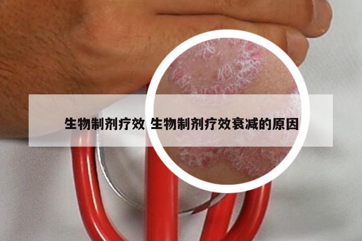 生物制剂疗效 生物制剂疗效衰减的原因