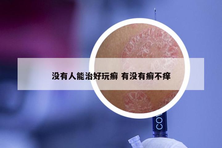 没有人能治好玩癣 有没有癣不痒