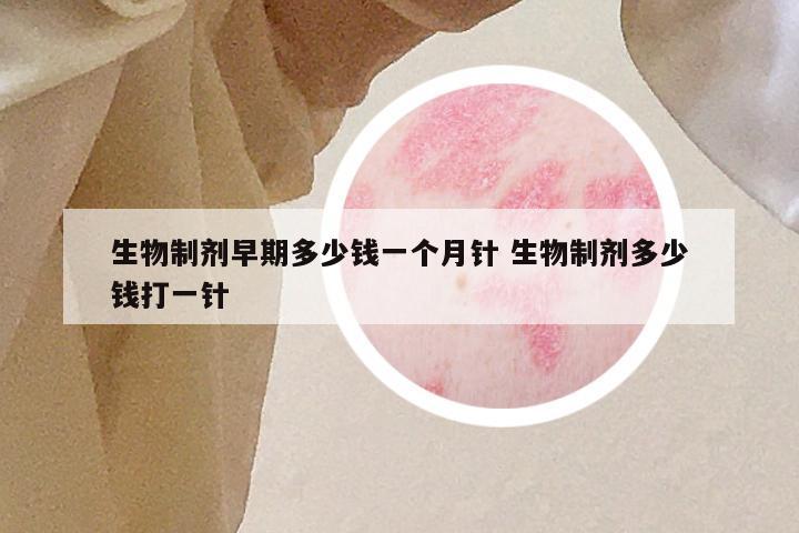 生物制剂早期多少钱一个月针 生物制剂多少钱打一针