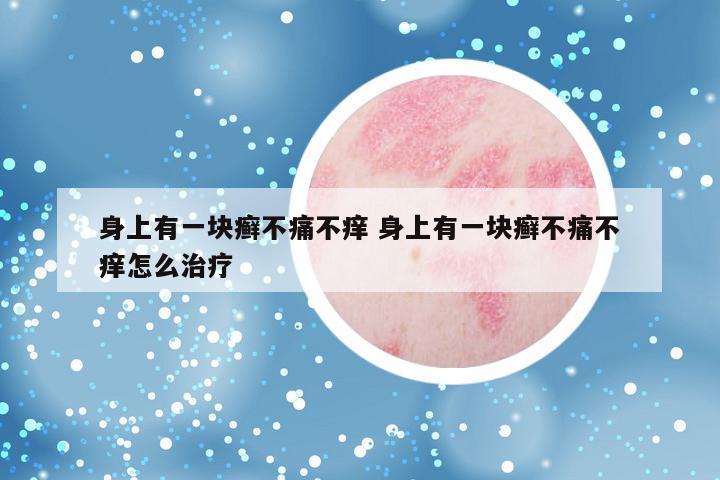 身上有一块癣不痛不痒 身上有一块癣不痛不痒怎么治疗