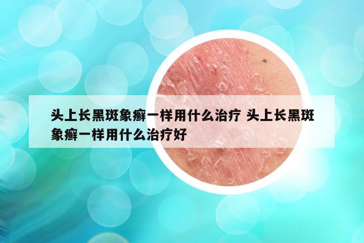 头上长黑斑象癣一样用什么治疗 头上长黑斑象癣一样用什么治疗好