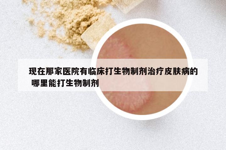 现在那家医院有临床打生物制剂治疗皮肤病的 哪里能打生物制剂