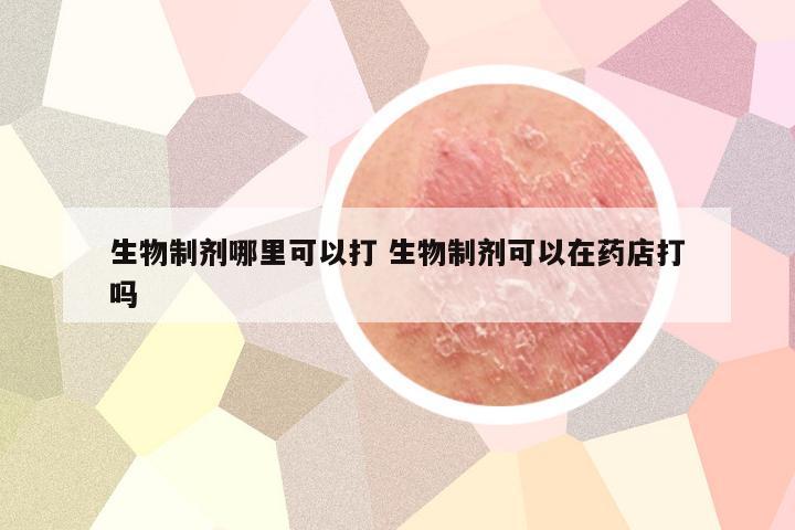 生物制剂哪里可以打 生物制剂可以在药店打吗