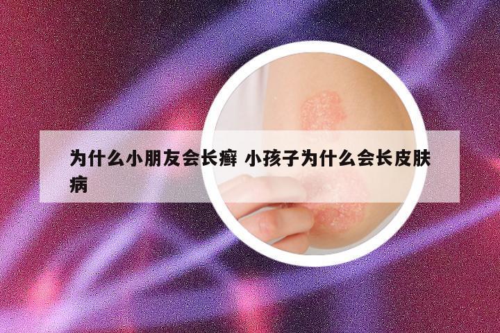 为什么小朋友会长癣 小孩子为什么会长皮肤病
