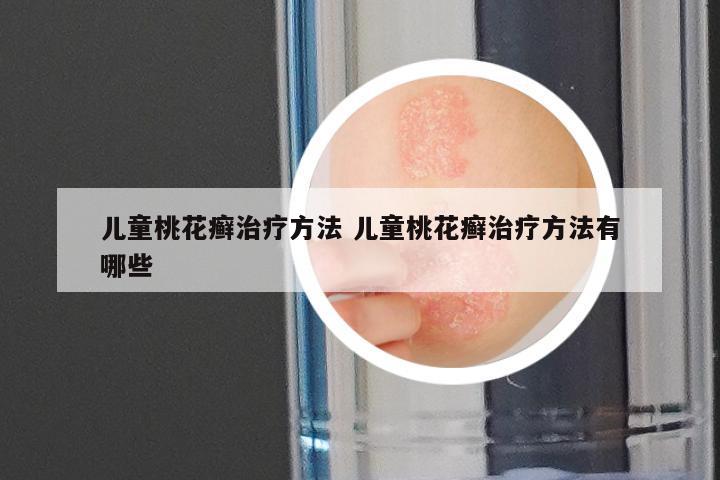 儿童桃花癣治疗方法 儿童桃花癣治疗方法有哪些