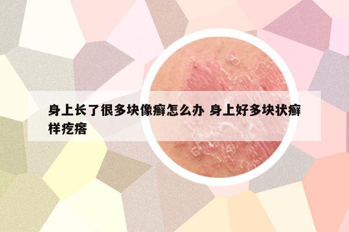 身上长了很多块像癣怎么办 身上好多块状癣样疙瘩