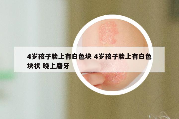 4岁孩子脸上有白色块 4岁孩子脸上有白色块状 晚上磨牙