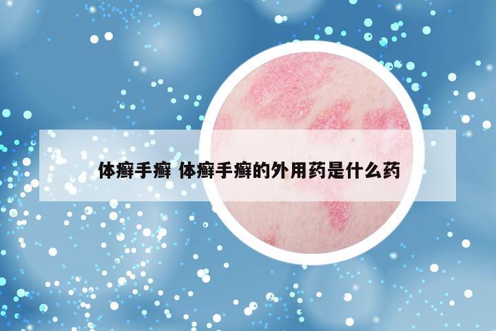 体癣手癣 体癣手癣的外用药是什么药