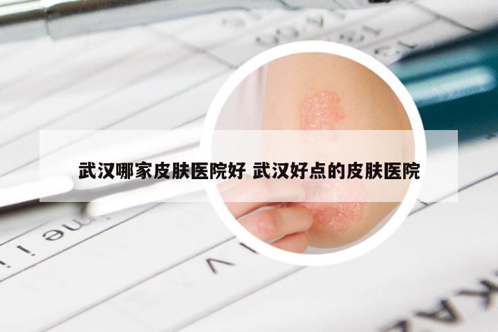 武汉哪家皮肤医院好 武汉好点的皮肤医院