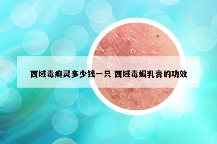 西域毒癣灵多少钱一只 西域毒蝎乳膏的功效