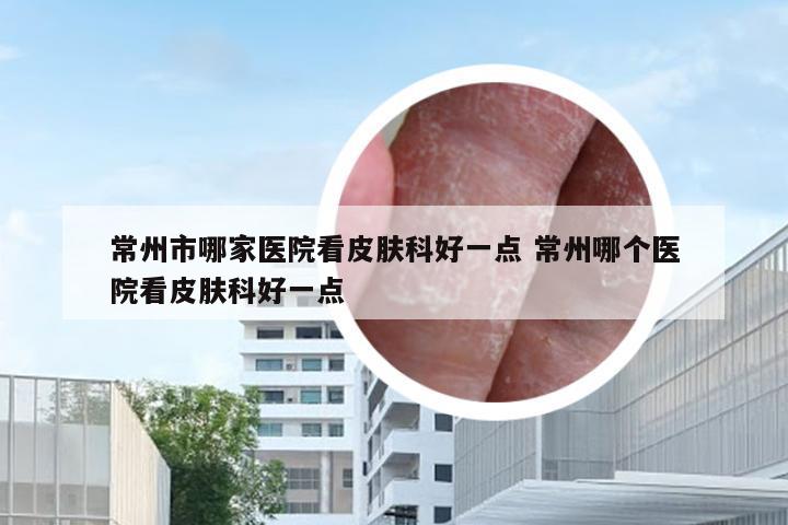 常州市哪家医院看皮肤科好一点 常州哪个医院看皮肤科好一点