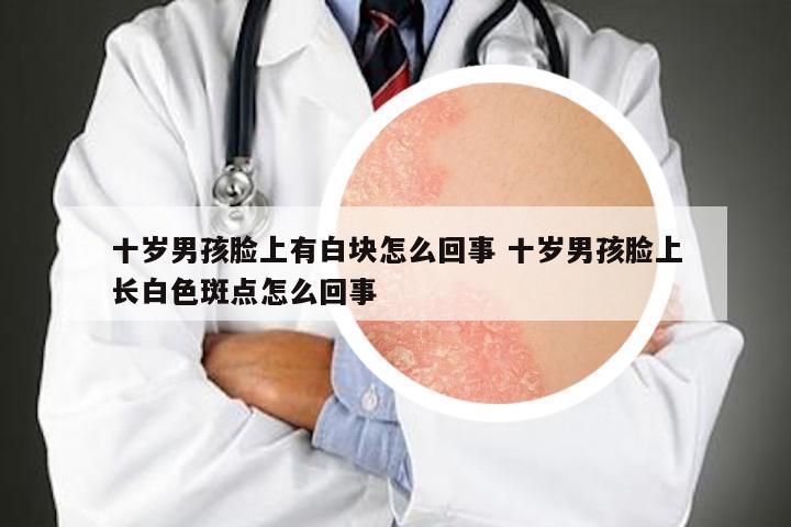 十岁男孩脸上有白块怎么回事 十岁男孩脸上长白色斑点怎么回事