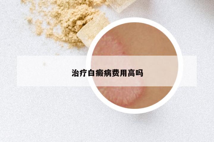 治疗白癜病费用高吗
