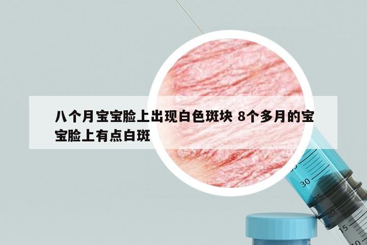 八个月宝宝脸上出现白色斑块 8个多月的宝宝脸上有点白斑