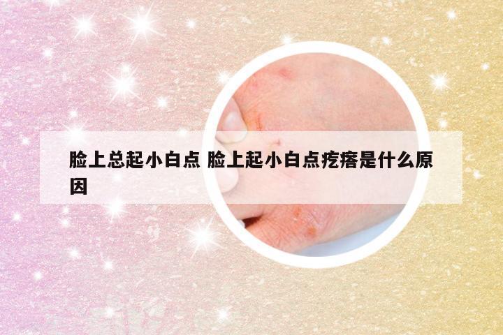 脸上总起小白点 脸上起小白点疙瘩是什么原因
