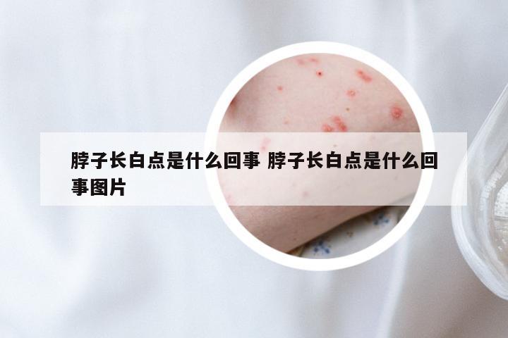 脖子长白点是什么回事 脖子长白点是什么回事图片