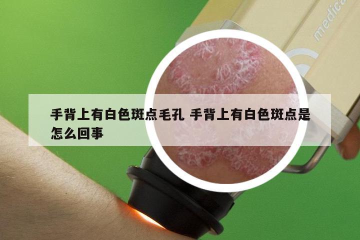 手背上有白色斑点毛孔 手背上有白色斑点是怎么回事
