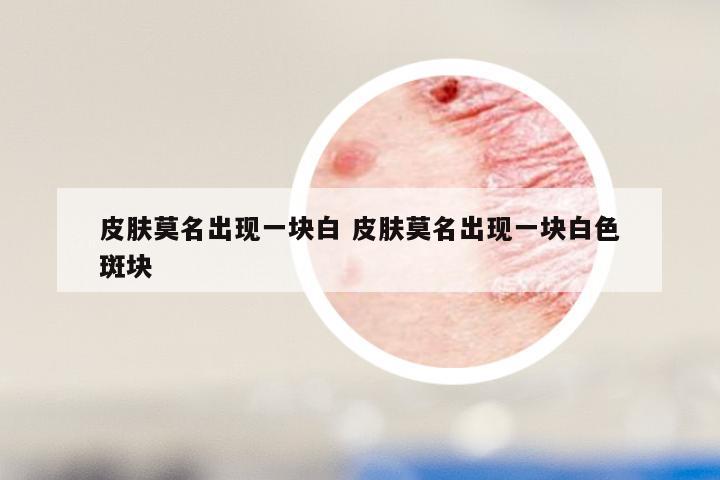 皮肤莫名出现一块白 皮肤莫名出现一块白色斑块