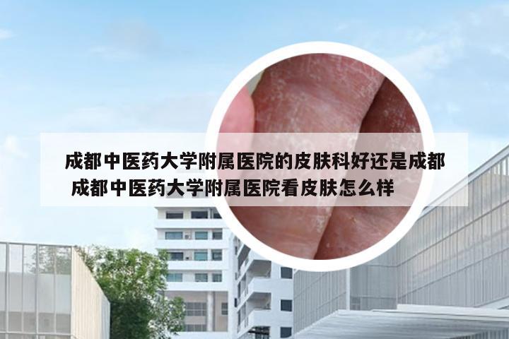 成都中医药大学附属医院的皮肤科好还是成都 成都中医药大学附属医院看皮肤怎么样