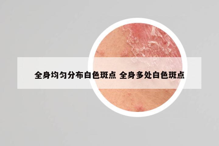全身均匀分布白色斑点 全身多处白色斑点