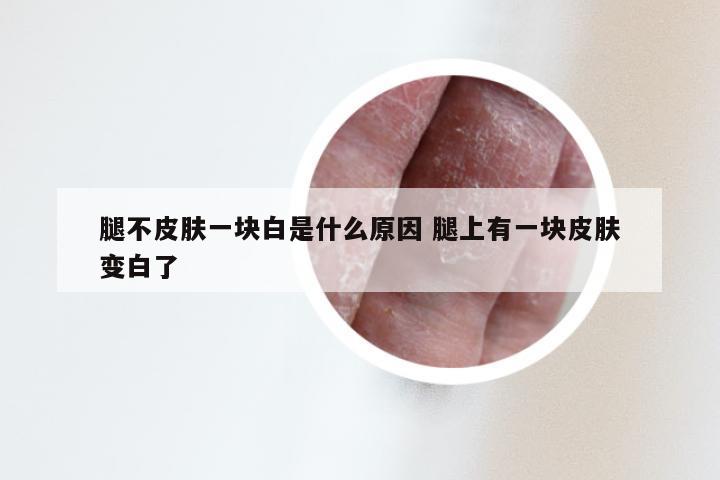腿不皮肤一块白是什么原因 腿上有一块皮肤变白了