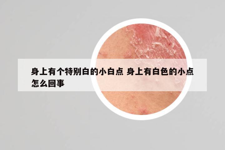 身上有个特别白的小白点 身上有白色的小点怎么回事