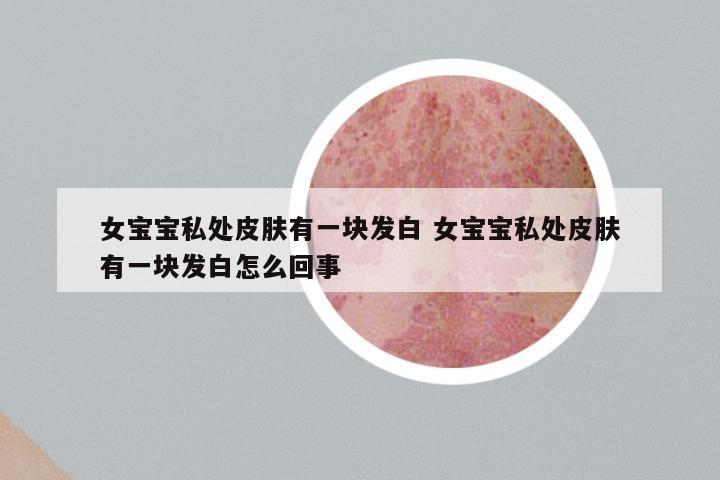 女宝宝私处皮肤有一块发白 女宝宝私处皮肤有一块发白怎么回事