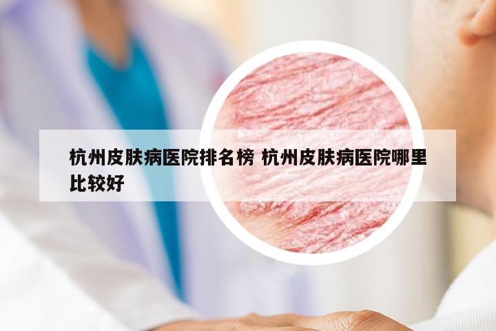 杭州皮肤病医院排名榜 杭州皮肤病医院哪里比较好