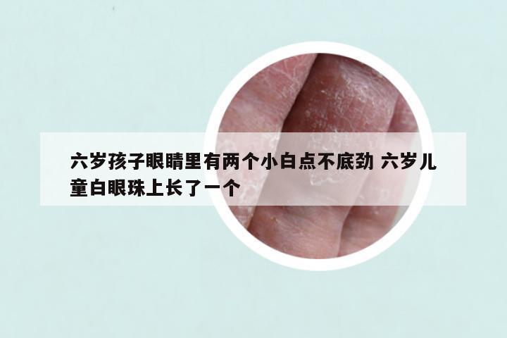 六岁孩子眼睛里有两个小白点不底劲 六岁儿童白眼珠上长了一个