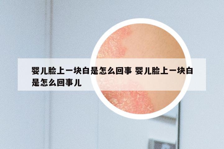 婴儿脸上一块白是怎么回事 婴儿脸上一块白是怎么回事儿