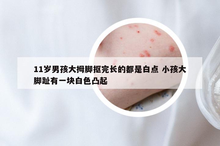 11岁男孩大拇脚抠完长的都是白点 小孩大脚趾有一块白色凸起