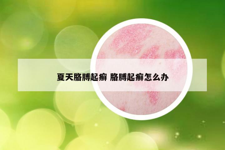 夏天胳膊起癣 胳膊起癣怎么办