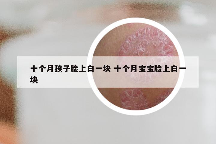 十个月孩子脸上白一块 十个月宝宝脸上白一块