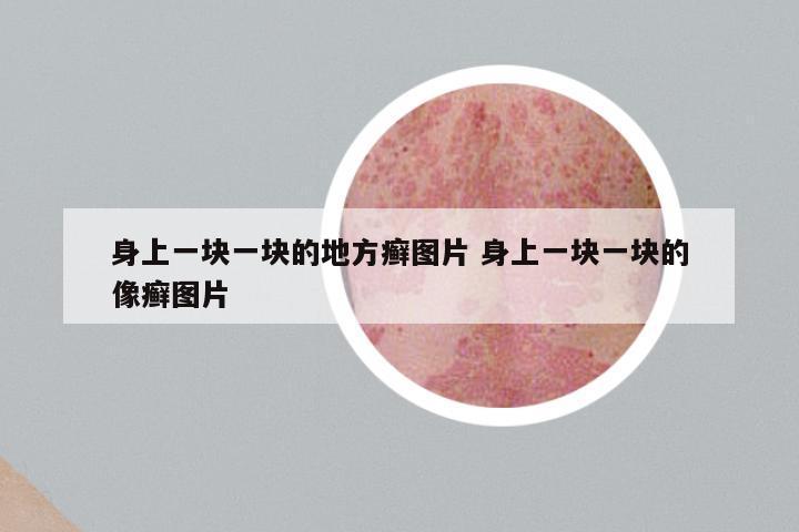 身上一块一块的地方癣图片 身上一块一块的像癣图片