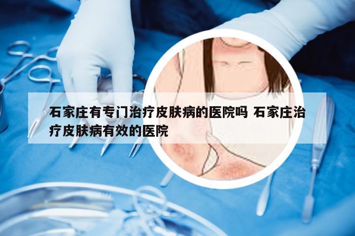 石家庄有专门治疗皮肤病的医院吗 石家庄治疗皮肤病有效的医院