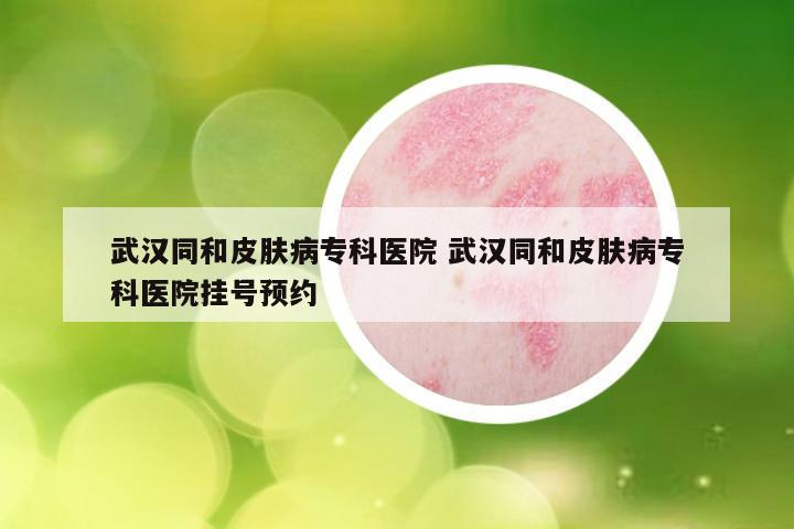 武汉同和皮肤病专科医院 武汉同和皮肤病专科医院挂号预约