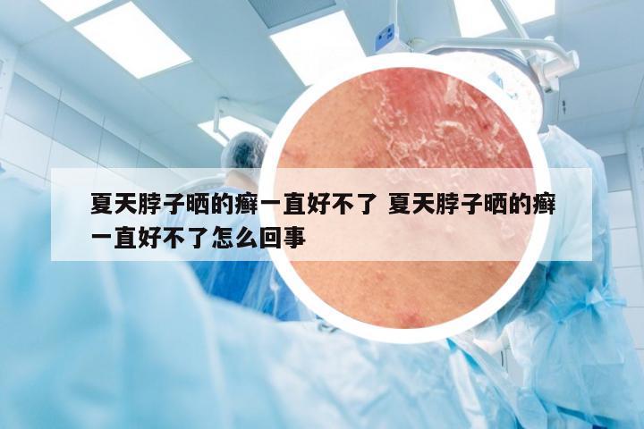 夏天脖子晒的癣一直好不了 夏天脖子晒的癣一直好不了怎么回事