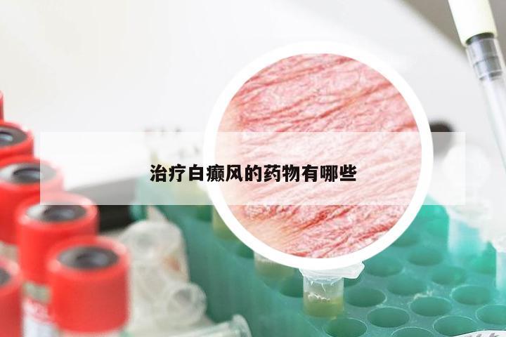 治疗白癫风的药物有哪些