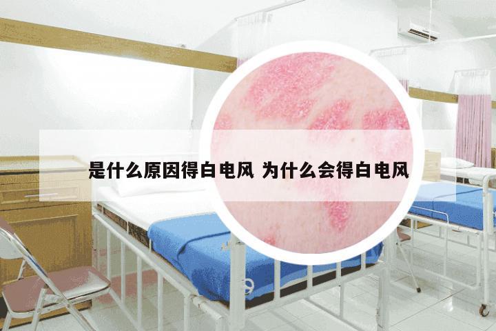 是什么原因得白电风 为什么会得白电风