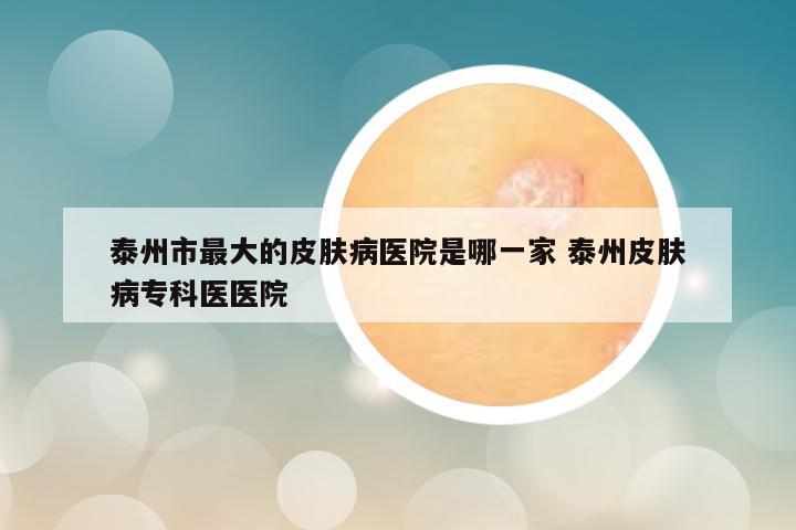 泰州市最大的皮肤病医院是哪一家 泰州皮肤病专科医医院