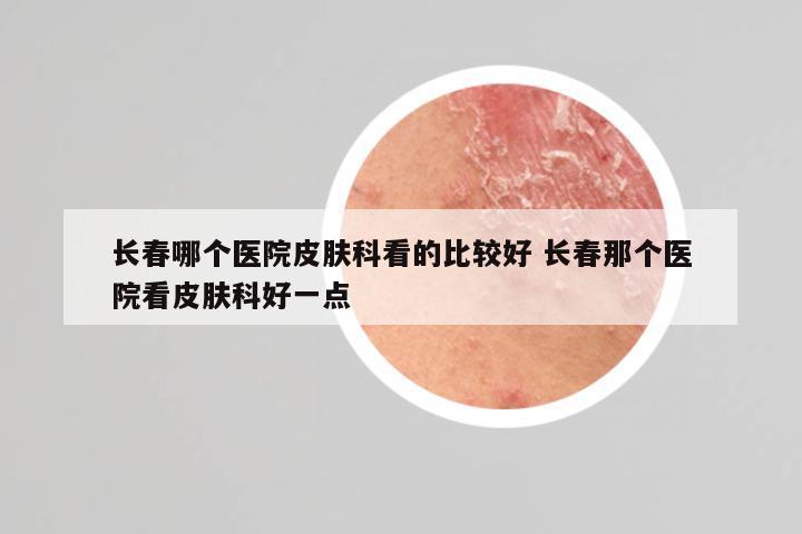 长春哪个医院皮肤科看的比较好 长春那个医院看皮肤科好一点