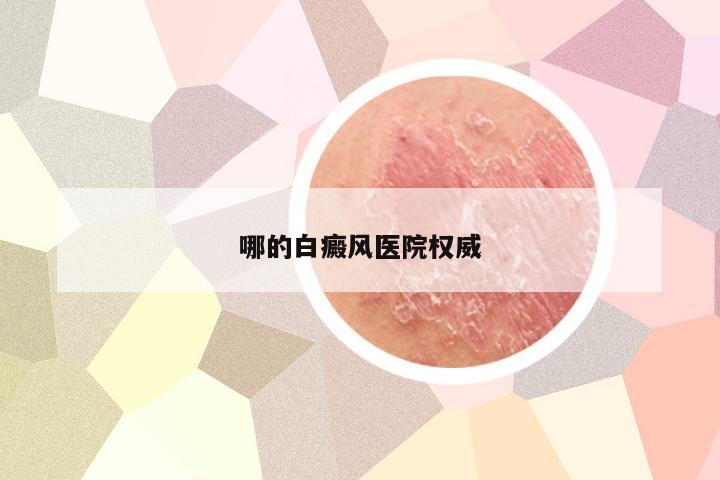 哪的白癜风医院权威