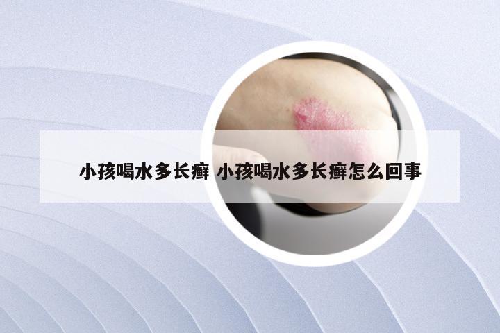 小孩喝水多长癣 小孩喝水多长癣怎么回事