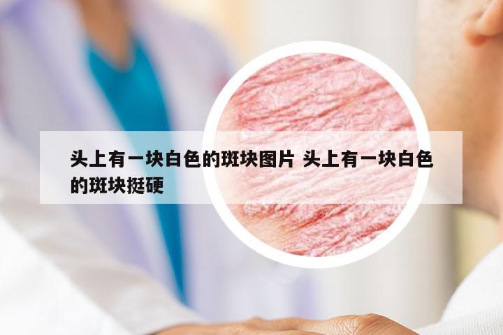 头上有一块白色的斑块图片 头上有一块白色的斑块挺硬