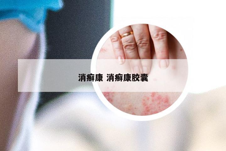 消癣康 消癣康胶囊