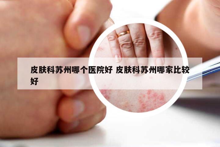皮肤科苏州哪个医院好 皮肤科苏州哪家比较好