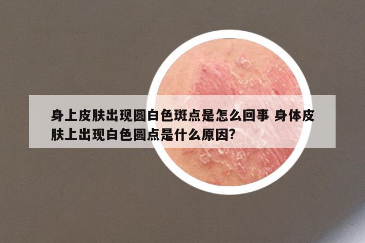 身上皮肤出现圆白色斑点是怎么回事 身体皮肤上出现白色圆点是什么原因?