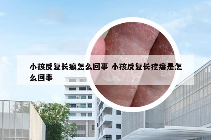 小孩反复长癣怎么回事 小孩反复长疙瘩是怎么回事