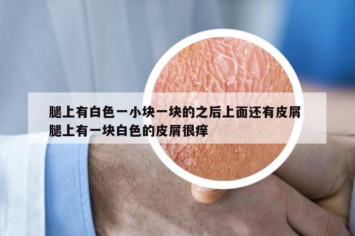 腿上有白色一小块一块的之后上面还有皮屑 腿上有一块白色的皮屑很痒